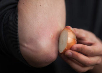 فوائد البصل الأبيض للبشرة