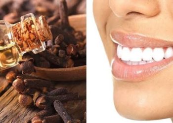 فوائد القرنفل للأسنان