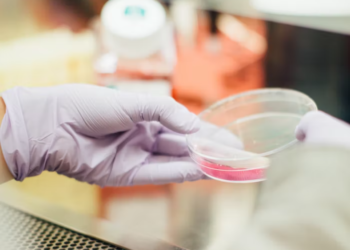 السلطات الصحية في ميشغان تؤكد تسجيل 43 إصابة بالإشريكية القولونية