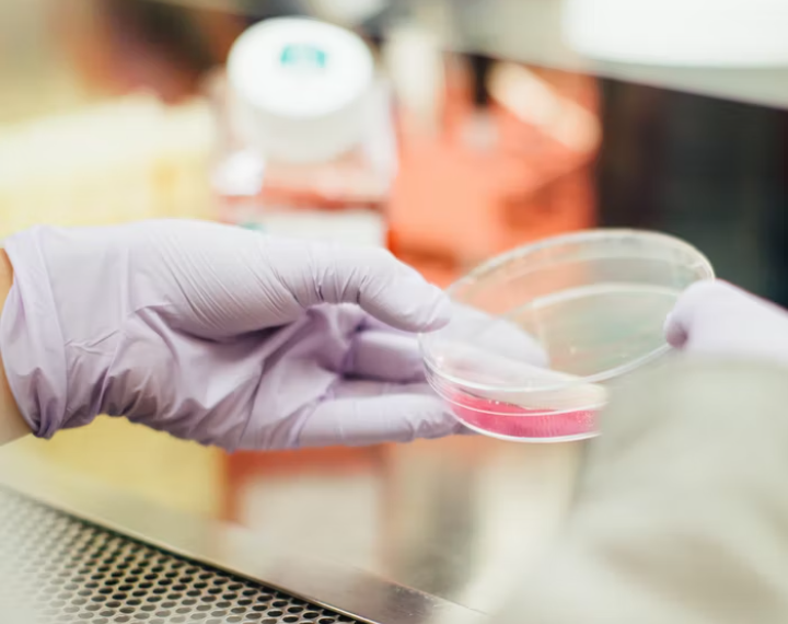 السلطات الصحية في ميشغان تؤكد تسجيل 43 إصابة بالإشريكية القولونية